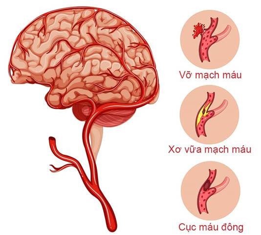 phong-chong-dot-quy-tu-thao-duoc-va-khoa-hoc-1